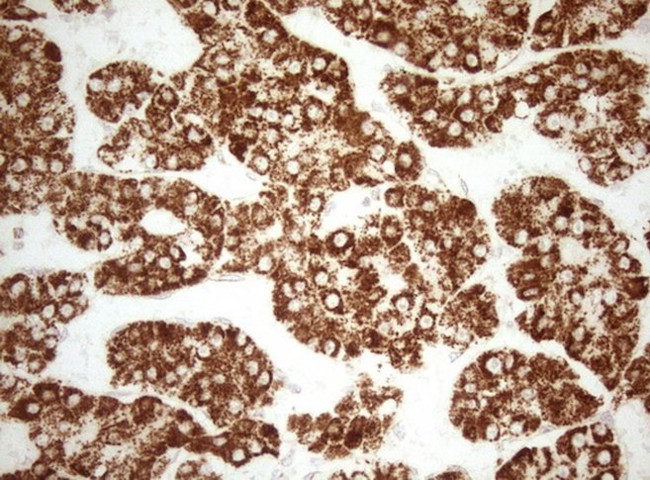 DECR1 Antibody in Immunohistochemistry (Paraffin) (IHC (P))