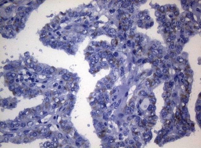 DECR1 Antibody in Immunohistochemistry (Paraffin) (IHC (P))