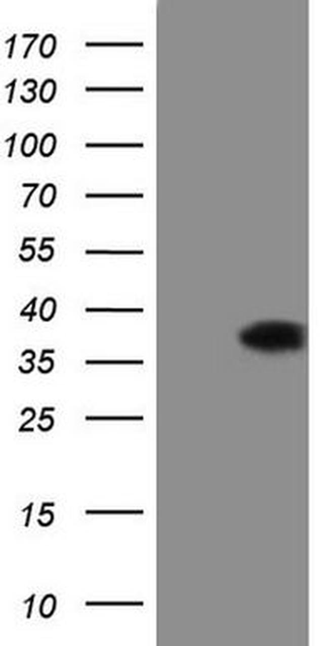 DECR1 Antibody in Western Blot (WB)