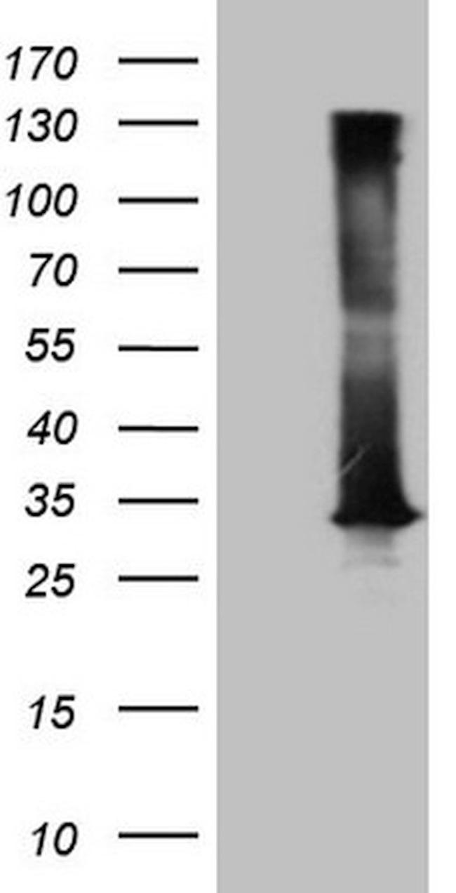 DECR1 Antibody in Western Blot (WB)