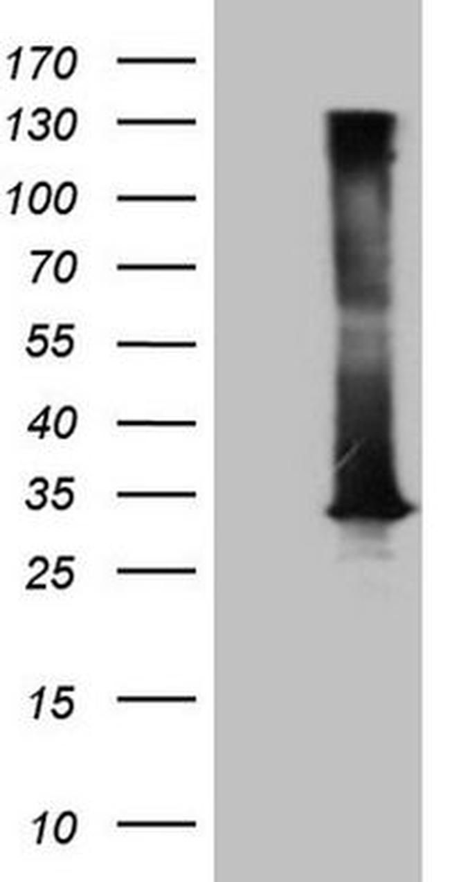 DECR1 Antibody in Western Blot (WB)