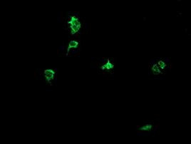 DEF6 Antibody in Immunocytochemistry (ICC/IF)