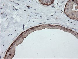 DEF6 Antibody in Immunohistochemistry (Paraffin) (IHC (P))