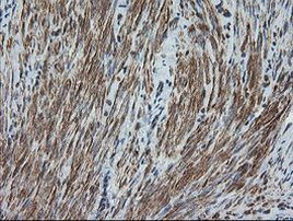 DEF6 Antibody in Immunohistochemistry (Paraffin) (IHC (P))