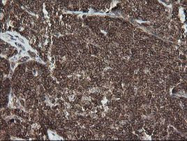 DEF6 Antibody in Immunohistochemistry (Paraffin) (IHC (P))