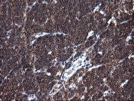 DEF6 Antibody in Immunohistochemistry (Paraffin) (IHC (P))