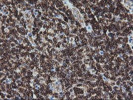 DEF6 Antibody in Immunohistochemistry (Paraffin) (IHC (P))