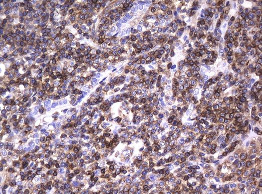 DEF6 Antibody in Immunohistochemistry (Paraffin) (IHC (P))