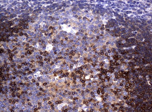 DEF6 Antibody in Immunohistochemistry (Paraffin) (IHC (P))