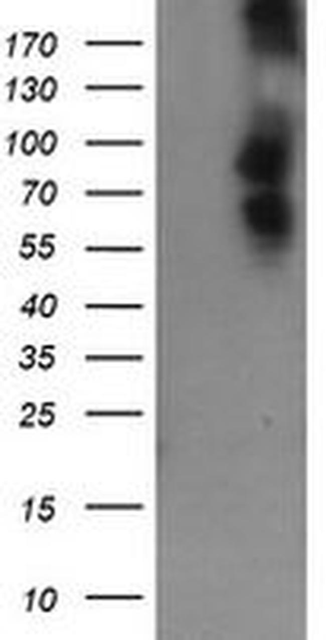 DEF6 Antibody in Western Blot (WB)