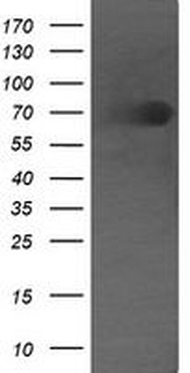 DEF6 Antibody in Western Blot (WB)