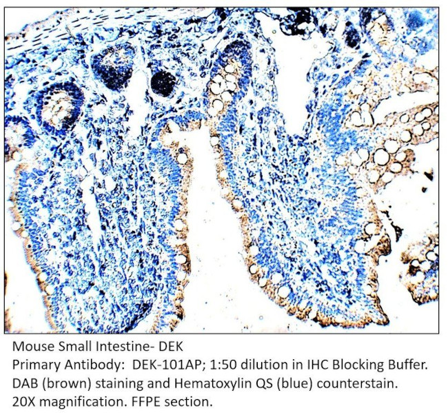 DEK Antibody in Immunohistochemistry (IHC)