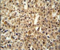 DENND1A Antibody in Immunohistochemistry (IHC)