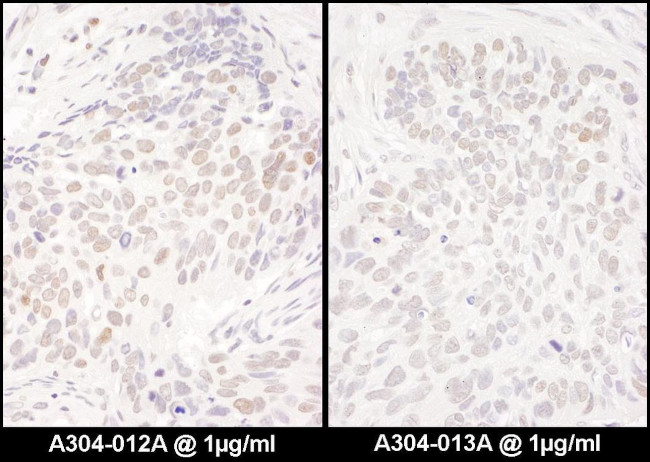 DENTT Antibody in Immunohistochemistry (IHC)