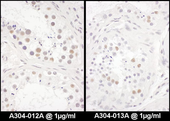 DENTT Antibody in Immunohistochemistry (IHC)