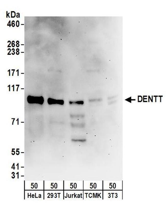 DENTT Antibody in Western Blot (WB)