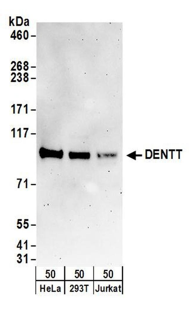 DENTT Antibody in Western Blot (WB)