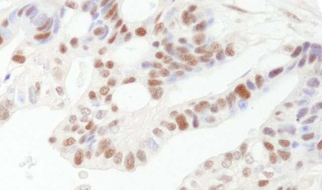 DFF45/DFFA Antibody in Immunohistochemistry (IHC)