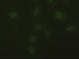 DFF45 Antibody in Immunocytochemistry (ICC/IF)