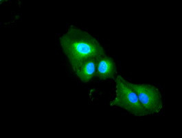 DFF45 Antibody in Immunocytochemistry (ICC/IF)