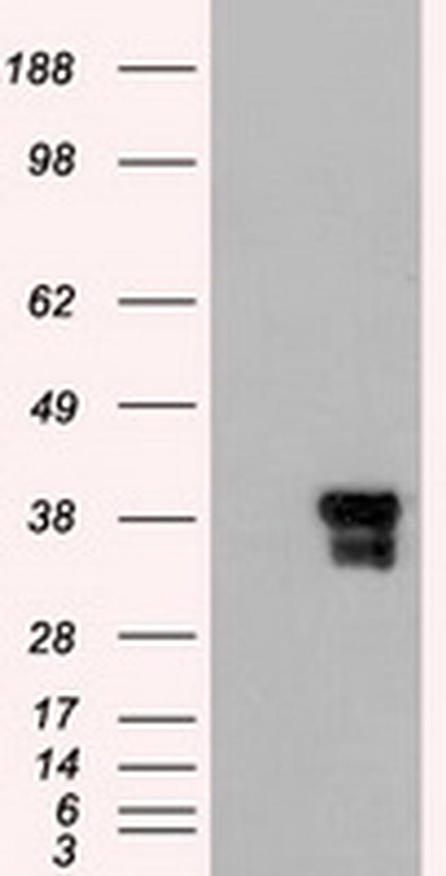 DFF45 Antibody in Western Blot (WB)