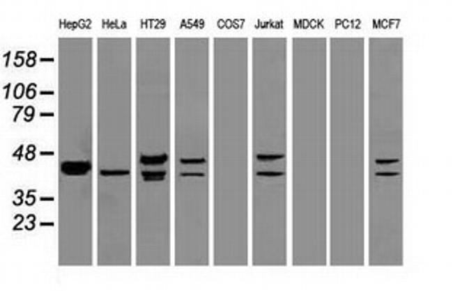 DFF45 Antibody in Western Blot (WB)