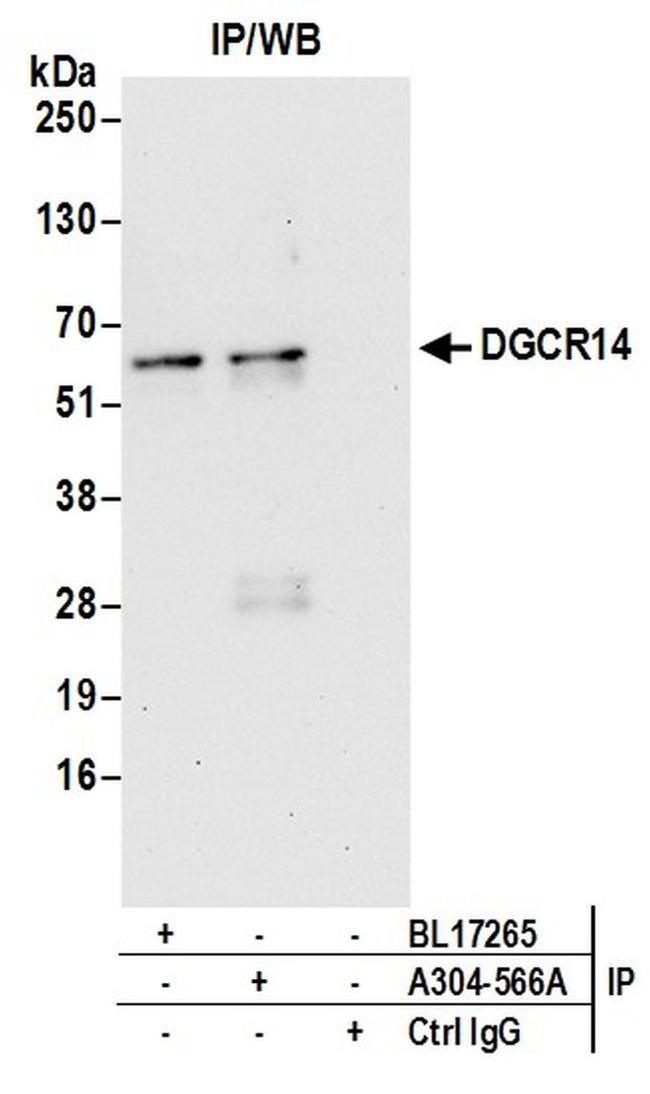 DGCR14 Antibody in Western Blot (WB)