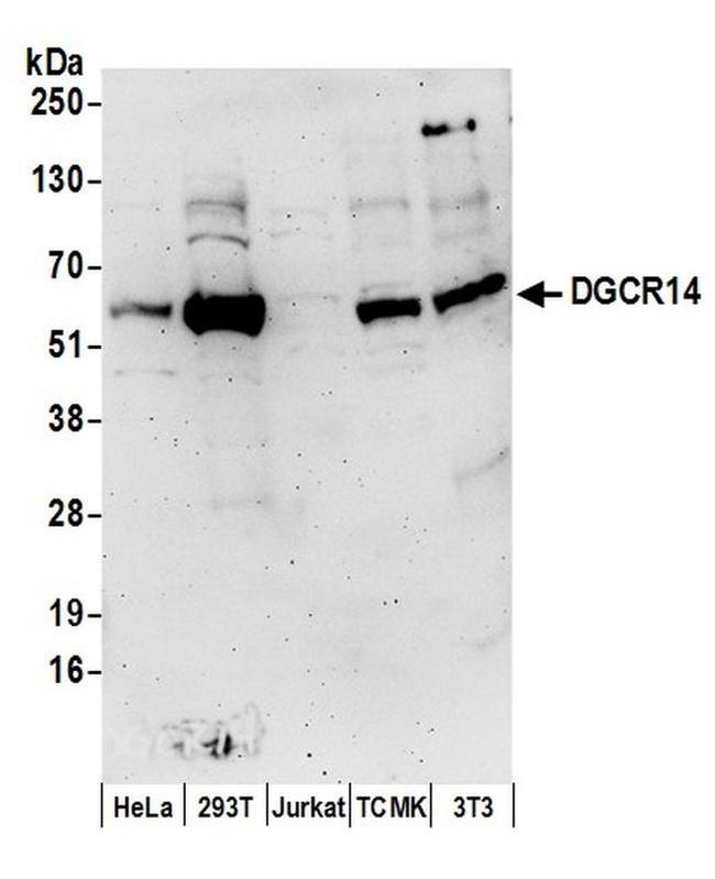 DGCR14 Antibody in Western Blot (WB)