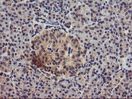 DGKA Antibody in Immunohistochemistry (Paraffin) (IHC (P))