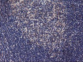 DGKA Antibody in Immunohistochemistry (Paraffin) (IHC (P))