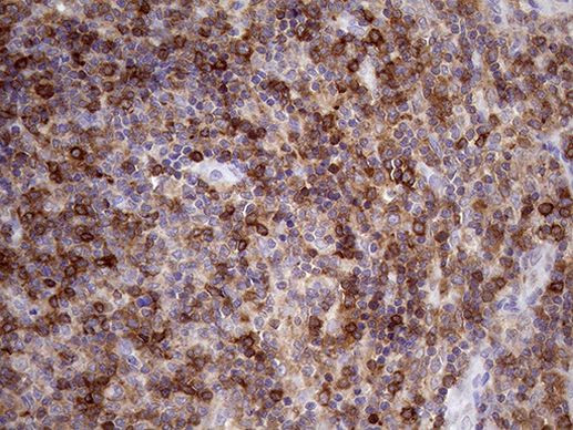 DGKZ Antibody in Immunohistochemistry (Paraffin) (IHC (P))