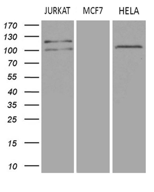 DGKZ Antibody in Western Blot (WB)