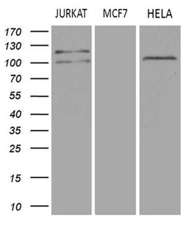 DGKZ Antibody in Western Blot (WB)