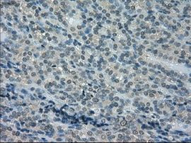 DHFR Antibody in Immunohistochemistry (Paraffin) (IHC (P))