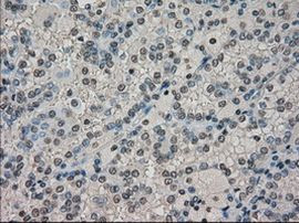 DHFR Antibody in Immunohistochemistry (Paraffin) (IHC (P))