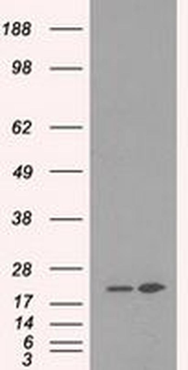 DHFR Antibody in Western Blot (WB)