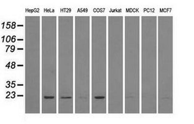 DHFR Antibody in Western Blot (WB)