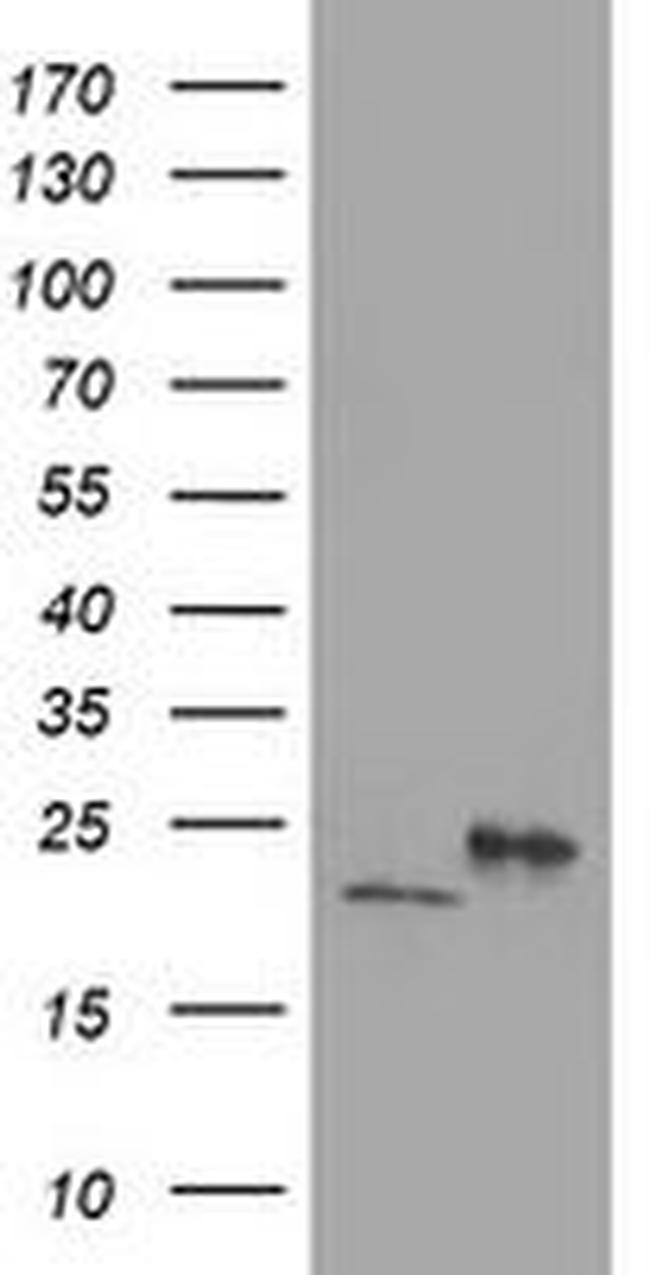 DHFRL1 Antibody in Western Blot (WB)
