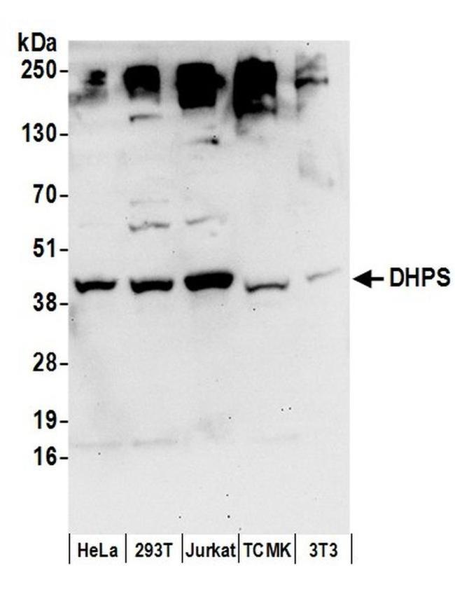 DHPS Antibody in Western Blot (WB)