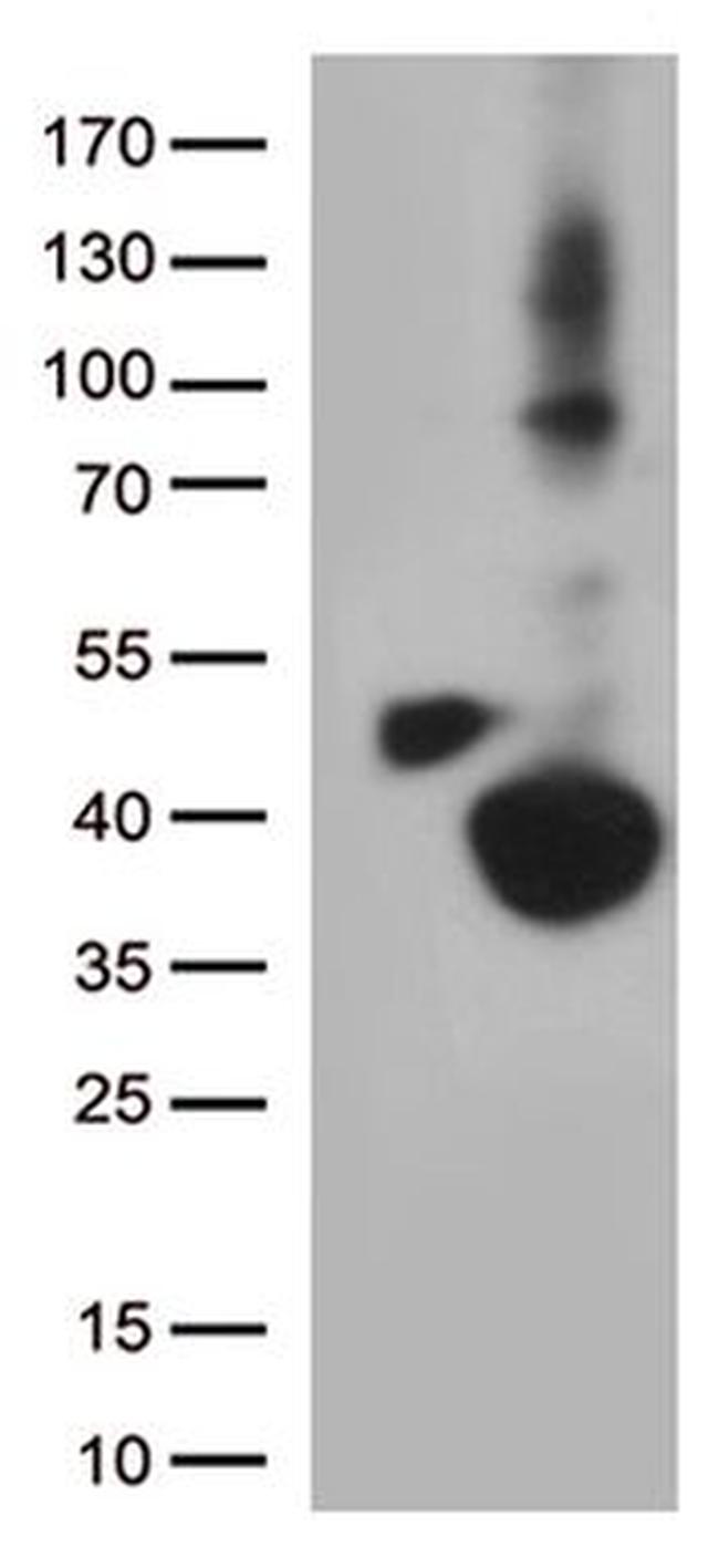 DHRS1 Antibody in Western Blot (WB)