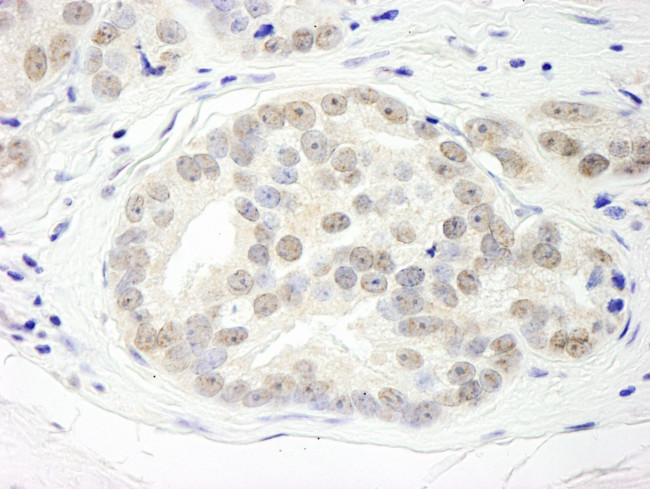 DHX15 Antibody in Immunohistochemistry (IHC)