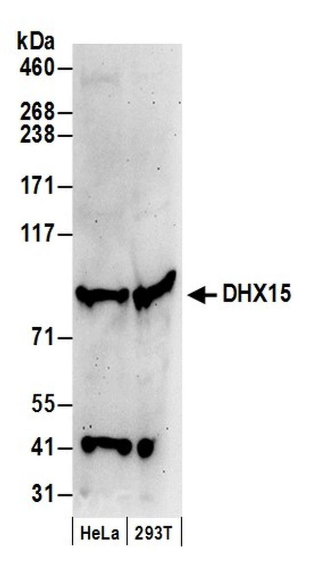 DHX15 Antibody in Western Blot (WB)