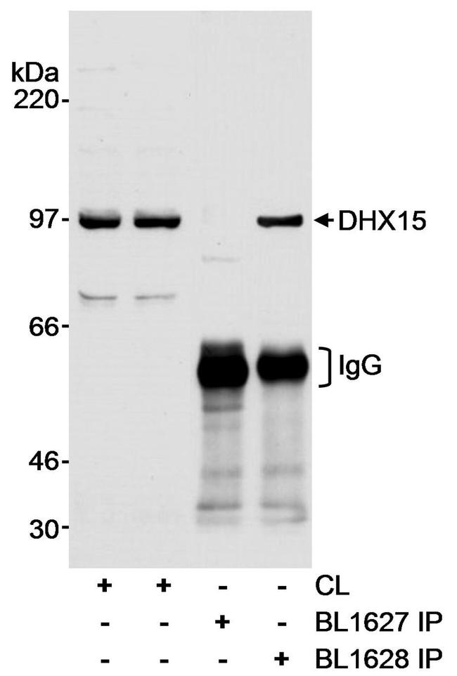 DHX15 Antibody in Western Blot (WB)