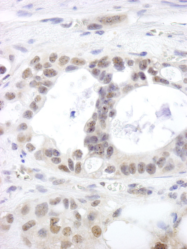 DHX15 Antibody in Immunohistochemistry (IHC)