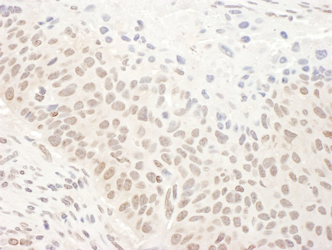 DHX33 Antibody in Immunohistochemistry (IHC)