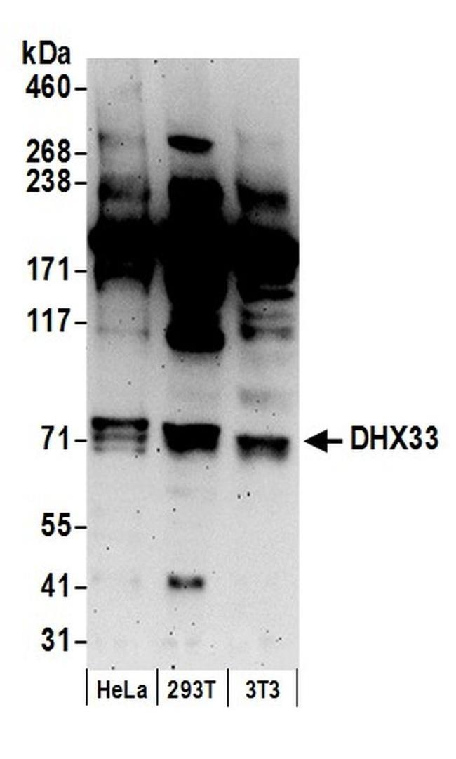 DHX33 Antibody in Western Blot (WB)