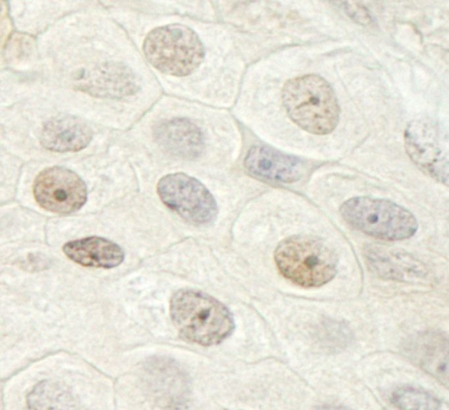 DHX33 Antibody in Immunohistochemistry (IHC)