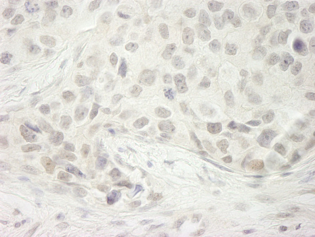 DHX33 Antibody in Immunohistochemistry (IHC)