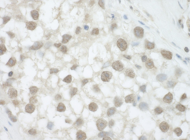 DHX36 Antibody in Immunohistochemistry (IHC)