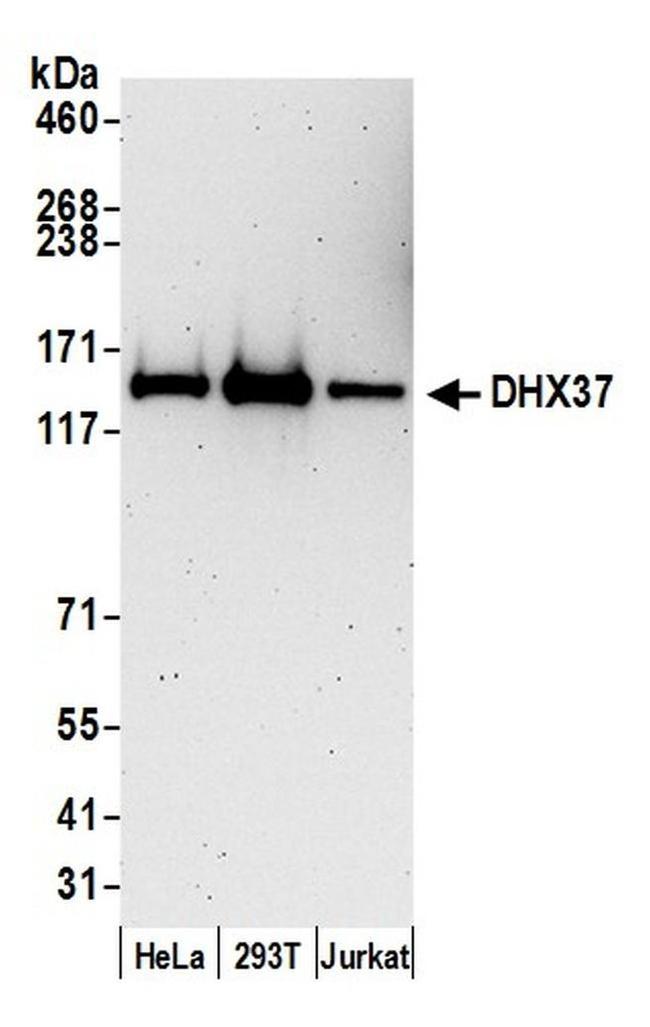 DHX37 Antibody in Western Blot (WB)